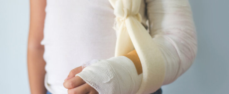 Child Injury with Broken Arm