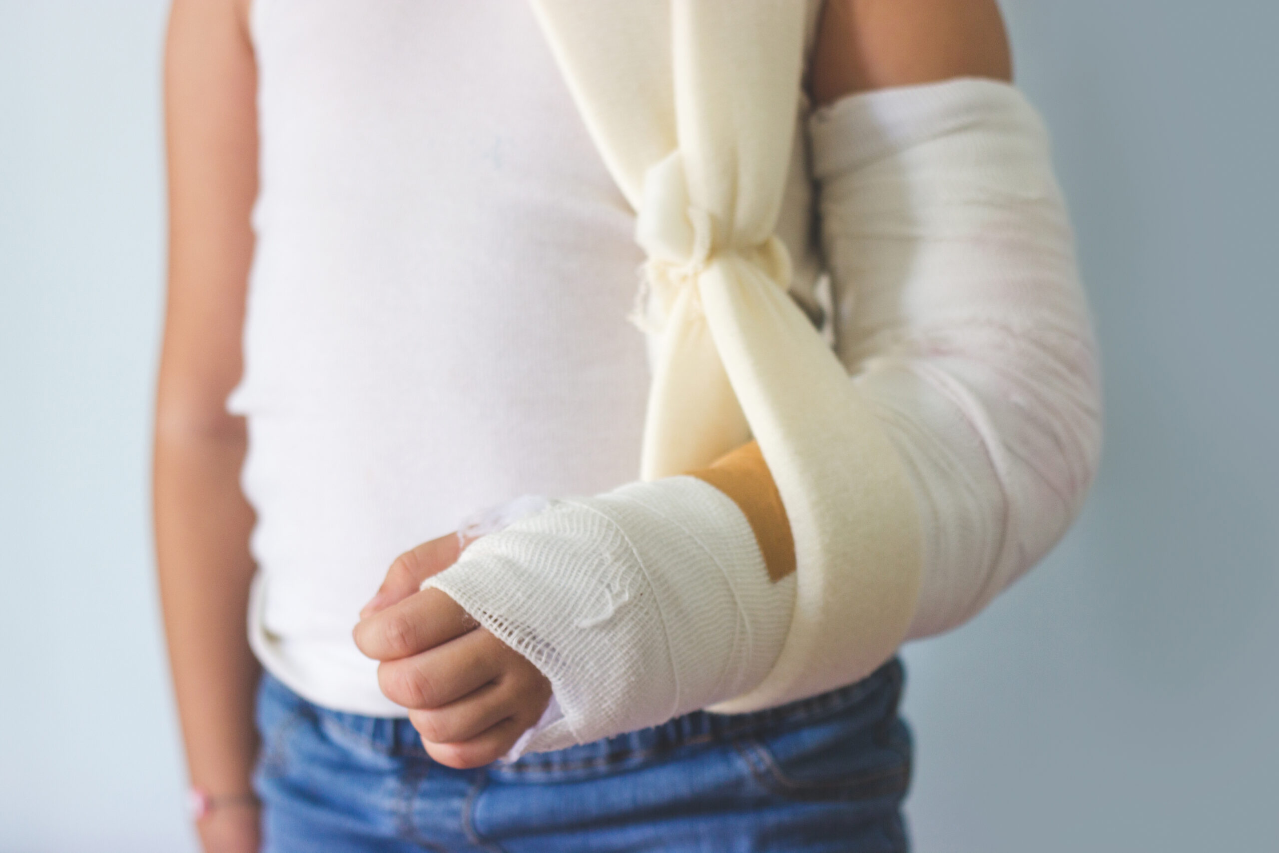 Child Injury with Broken Arm