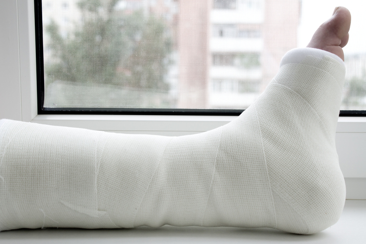 Man's leg in a plaster cast